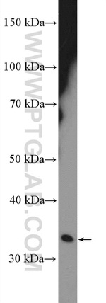 CENPP Antibody in Western Blot (WB)