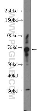 CPNE5 Antibody in Western Blot (WB)