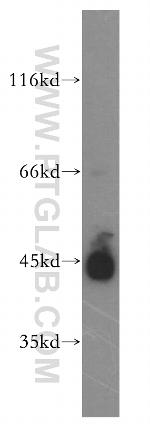 B3GNT3 Antibody in Western Blot (WB)