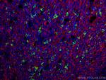 PD-1/CD279 Antibody in Multiplex Immunohistochemistry (mIHC)