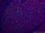 PD-1/CD279 Antibody in Multiplex Immunohistochemistry (mIHC)
