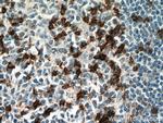 PD-1/CD279 Antibody in Immunohistochemistry (Paraffin) (IHC (P))