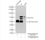 PHACTR3 Antibody in Immunoprecipitation (IP)