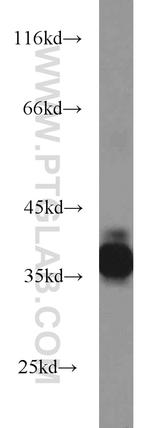 PRPH2 Antibody in Western Blot (WB)