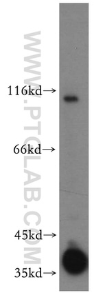 PRPH2 Antibody in Western Blot (WB)