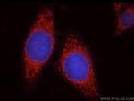 Uroguanylin Antibody in Immunocytochemistry (ICC/IF)