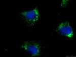 COX7A2 Antibody in Immunocytochemistry (ICC/IF)