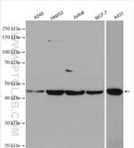 PARP15 Antibody in Western Blot (WB)