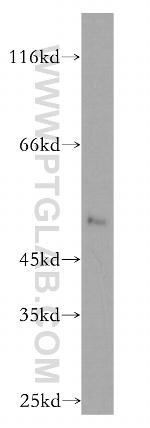 PARP15 Antibody in Western Blot (WB)