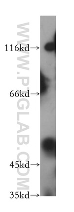 PARP15 Antibody in Western Blot (WB)