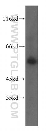 RAB11FIP2 Antibody in Western Blot (WB)