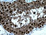 importin alpha 5 Antibody in Immunohistochemistry (Paraffin) (IHC (P))