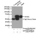 importin alpha 5 Antibody in Immunoprecipitation (IP)