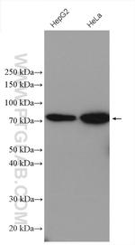 ABCD1 Antibody in Western Blot (WB)