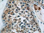 HYAL4 Antibody in Immunohistochemistry (Paraffin) (IHC (P))
