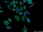 HRC Antibody in Immunocytochemistry (ICC/IF)