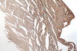 HRC Antibody in Immunohistochemistry (Paraffin) (IHC (P))