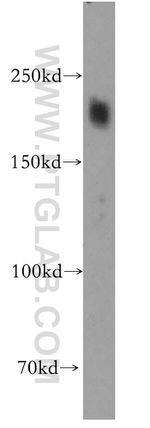 HRC Antibody in Western Blot (WB)