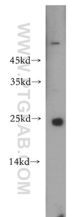 RAB9B Antibody in Western Blot (WB)