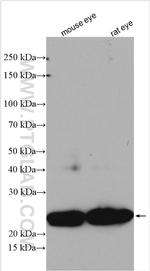 CRYBB2 Antibody in Western Blot (WB)