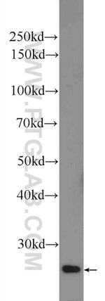 CRYBB2 Antibody in Western Blot (WB)
