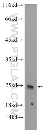 CRYBB2 Antibody in Western Blot (WB)