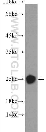 CRYBB2 Antibody in Western Blot (WB)