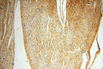 ZNF174 Antibody in Immunohistochemistry (Paraffin) (IHC (P))