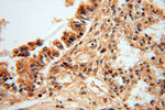 ZNF174 Antibody in Immunohistochemistry (Paraffin) (IHC (P))