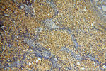 ZNF174 Antibody in Immunohistochemistry (Paraffin) (IHC (P))