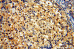 ZNF174 Antibody in Immunohistochemistry (Paraffin) (IHC (P))