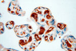 ZNF174 Antibody in Immunohistochemistry (Paraffin) (IHC (P))