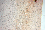 ZNF174 Antibody in Immunohistochemistry (Paraffin) (IHC (P))
