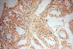 ZNF174 Antibody in Immunohistochemistry (Paraffin) (IHC (P))