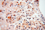 ZNF174 Antibody in Immunohistochemistry (Paraffin) (IHC (P))