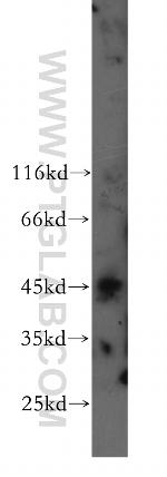 ZNF174 Antibody in Western Blot (WB)