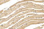MYL6 Antibody in Immunohistochemistry (Paraffin) (IHC (P))