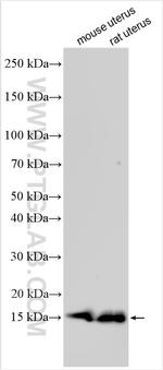 MYL6 Antibody in Western Blot (WB)