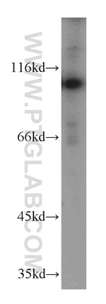 PMS2 Antibody in Western Blot (WB)