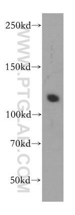 PMS2 Antibody in Western Blot (WB)