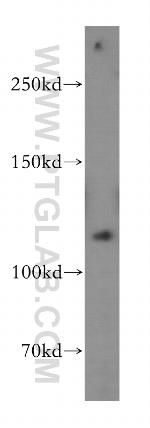 PMS2 Antibody in Western Blot (WB)