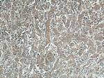 WISP1 Antibody in Immunohistochemistry (Paraffin) (IHC (P))