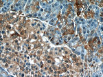 AMPK alpha 2 Antibody in Immunohistochemistry (Paraffin) (IHC (P))