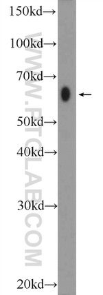AMPK alpha 2 Antibody in Western Blot (WB)