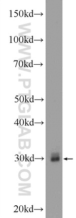 FGF5 Antibody in Western Blot (WB)