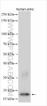RNASE2 Antibody in Western Blot (WB)