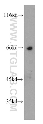 Frizzled 10 Antibody in Western Blot (WB)