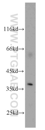 AIP/ARA9 Antibody in Western Blot (WB)