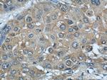 AIP/ARA9 Antibody in Immunohistochemistry (Paraffin) (IHC (P))