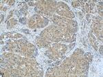 AIP/ARA9 Antibody in Immunohistochemistry (Paraffin) (IHC (P))